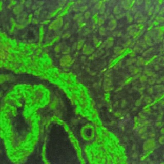 @autoimmunn