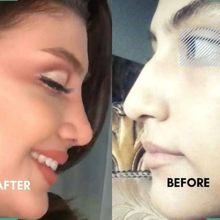 خدمات دندانپزشکی و زیبایی بهاره ۲۰%آف