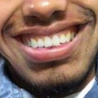 @MrLimbo_7