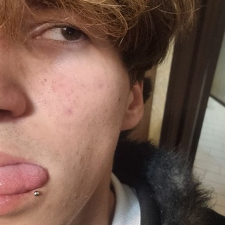 @UglyBitchUh